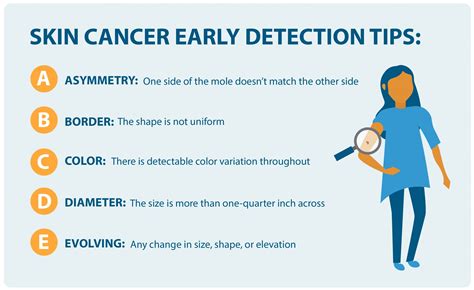 How to Detect .